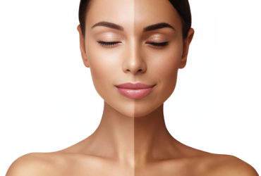 De-tan facial treatment for sun-exposed skin